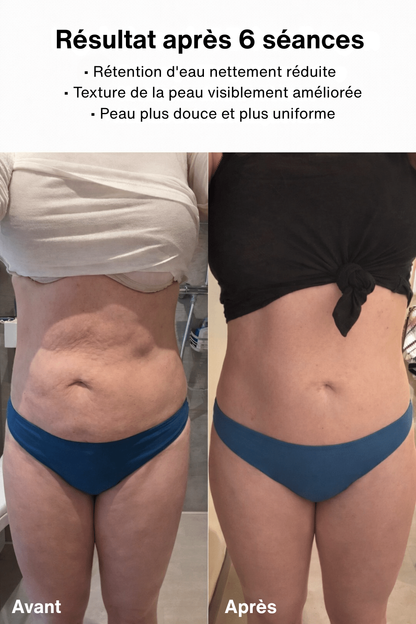 CelluFix