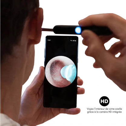 OtoClean – caméra HD