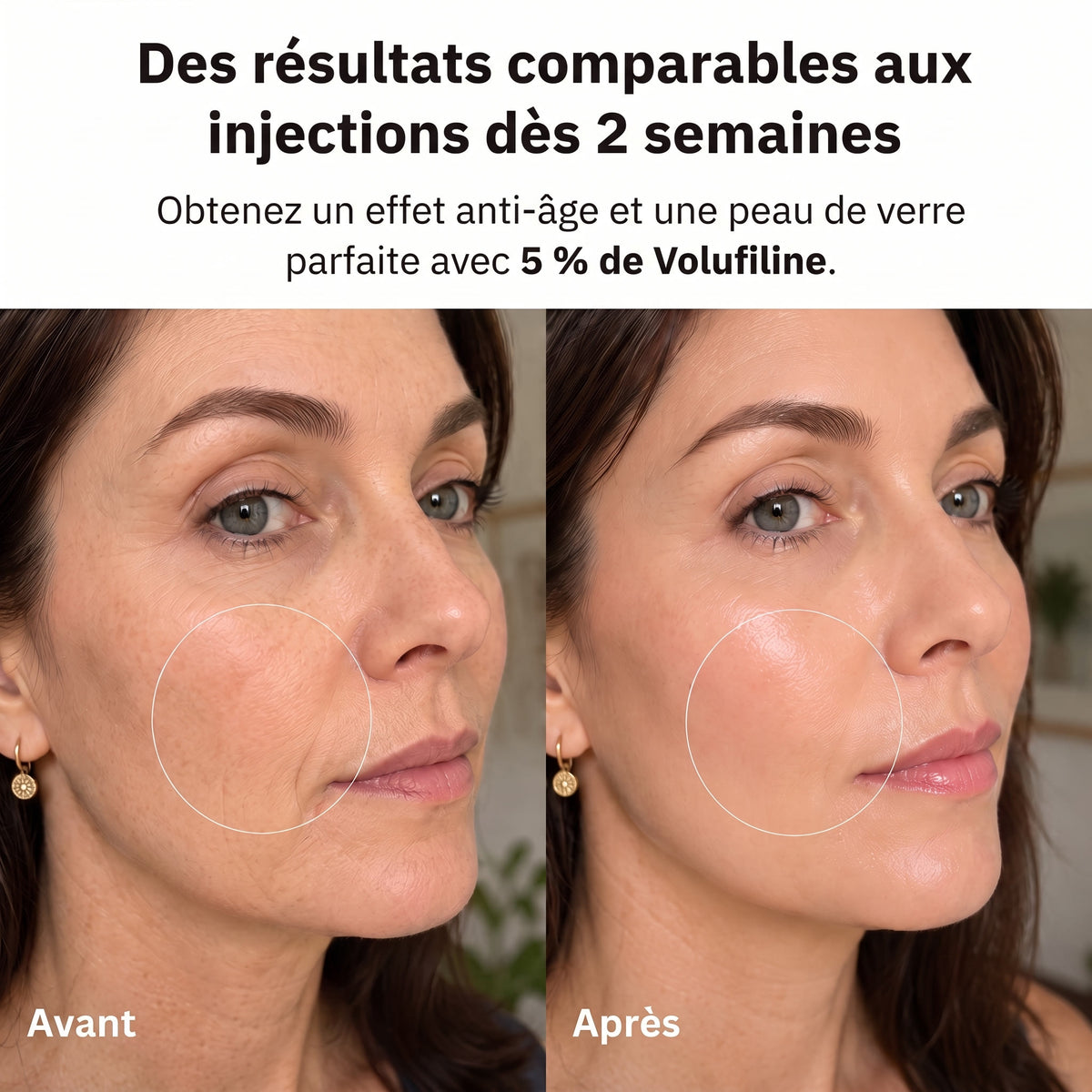 Des résultats comparables aux injections dès 2 semaines
